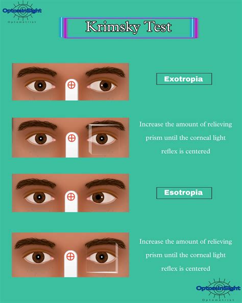 corneal reflex test results|Corneal Reflex: Function, Assessment, and Clinical Significance.